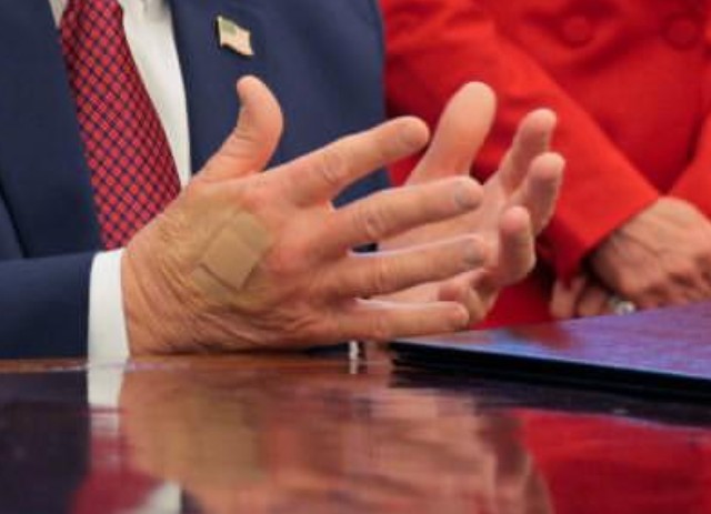 BREAKING: Trump’s White House Doctor REFUSES to Reveal His SERIOUS Health Diagnosis After He’s Repeatedly Seen With Band-Aids on His Hand — and the Real Reason He Has Been Uncontrollably Falling Asleep During Meetings